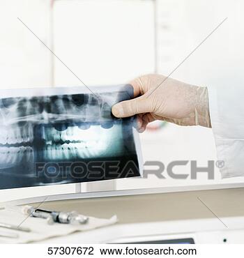 Stock Photo - medical professional 
holding the x-ray 
report. fotosearch 
- search stock 
photos, pictures, 
images, and photo 
clipart
