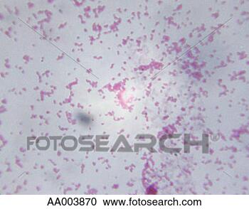 bordetella pertussis whooping cough