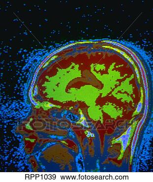 Stock Photograph - computer screen 
with image of 
mri brain scan. 
fotosearch - search 
stock photos, 
pictures, images, 
and photo clipart