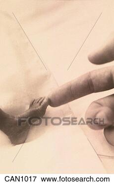 Picture - b/w hand touching 
preemie baby's 
big toe; scale. 
fotosearch - search 
stock photos, 
pictures, images, 
and photo clipart