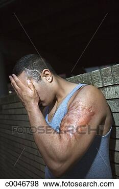 Stock Photo - injured man. fotosearch 
- search stock 
photos, pictures, 
images, and photo 
clipart