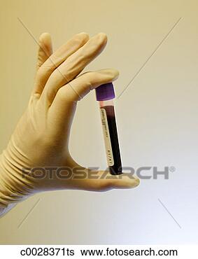 Stock Photo - medical close-up 
of a gloved hand 
holding a vile 
of blood. fotosearch 
- search stock 
photos, pictures, 
images, and photo 
clipart