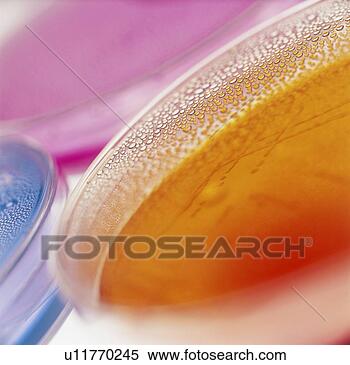 Stock Image - close-up of petri 
dishes with bacterial 
cultures. fotosearch 
- search stock 
photos, pictures, 
wall murals, images, 
and photo clipart