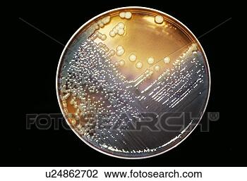 Stock Photo - cultured enterobacter 
bacteria. fotosearch 
- search stock 
photos, pictures, 
wall murals, images, 
and photo clipart