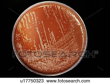 Stock Photo - cultured meningitis 
bacteria. fotosearch 
- search stock 
photos, pictures, 
wall murals, images, 
and photo clipart