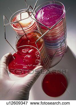 Picture - petri dish bacterial 
culture being 
placed in stack. 
fotosearch - search 
stock photos, 
pictures, wall 
murals, images, 
and photo clipart