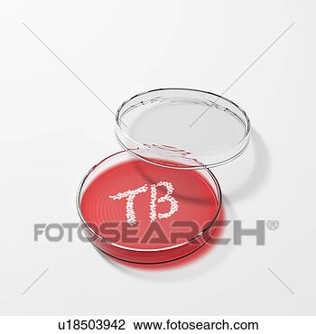 Stock Photo - conceptual computer 
artwork showing 
tuberculosis (tb) 
bacteria. fotosearch 
- search stock 
photos, pictures, 
wall murals, images, 
and photo clipart