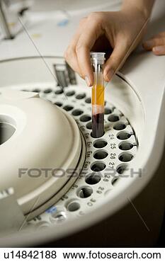 Banco de Imagem - enfermeira,  segurando, 
 teste,  tubo. 
fotosearch - busca 
de fotos, imagens 
e clipart