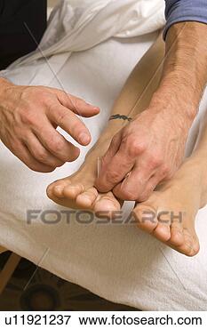 Picture - acupuncture on 
foot. fotosearch 
- search stock 
photos, pictures, 
images, and photo 
clipart