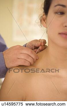 Stock Image - acupuncturist 
working on woman's 
shoulder. fotosearch 
- search stock 
photos, pictures, 
images, and photo 
clipart