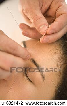Stock Photo - doctor inserting 
acupuncture needle 
in woman's  forehead. 
fotosearch - search 
stock photos, 
pictures, images, 
and photo clipart