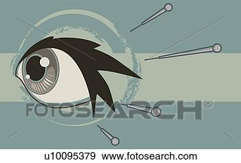 Stock Illustration - close-up of a 
botox injection 
injecting into 
human eye. fotosearch 
- search clipart, 
illustration, 
drawings and vector 
eps graphics images