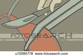 Arquivos de Ilustrações - close-up,  cirurgião, 
 mão,  corte, 
 human,  veia, 
 bisturi. fotosearch 
- busca de ilustrações 
clipeart e desenhos