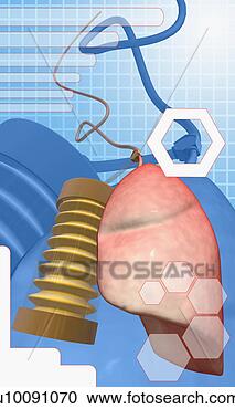 Stock Illustration - close-up of artificial 
pumps and a human 
kidney. fotosearch 
- search clipart, 
illustration, 
drawings and vector 
eps graphics images