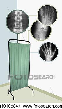 Stock Illustration - x-ray images over 
a hospital screen. 
fotosearch - search 
clipart, illustration, 
drawings and vector 
eps graphics images