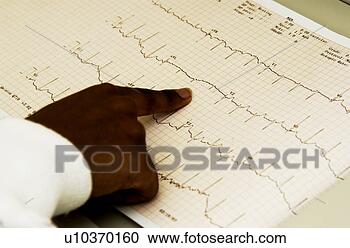 Arquivo de Fotografias - africano,  americano, 
 técnico,  monitorando, 
 ekg,  máquina. 
fotosearch - busca 
de fotos, imagens 
e clipart