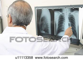 Banco de Imagem - médico,  explicando, 
 raio x. fotosearch 
- busca de fotos, 
imagens e clipart