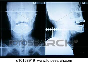 Arquivo Fotográficos - hospitalar,  doença, 
 elétrico,  luz, 
 raio x. fotosearch 
- busca de fotos, 
imagens e clipart