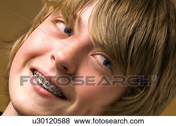 Stock Photo - boy with braces 
on his teeth. 
fotosearch - search 
stock photos, 
pictures, images, 
and photo clipart
