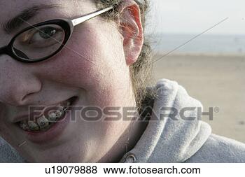 Stock Photo - woman wearing 
glasses and braces, 
close-up. fotosearch 
- search stock 
photos, pictures, 
images, and photo 
clipart