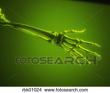 Stock Photo - human hand and 
arm skeleton. 
fotosearch - search 
stock photos, 
pictures, images, 
and photo clipart