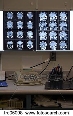 Stock Photo - x-rays of human 
brain. fotosearch 
- search stock 
photos, pictures, 
images, and photo 
clipart