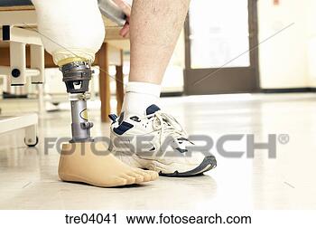 Stock Photography - patient using 
prosthetic leg. 
fotosearch - search 
stock photos, 
pictures, images, 
and photo clipart
