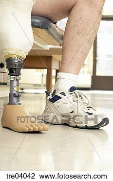 Stock Photo - patient using 
prosthetic leg. 
fotosearch - search 
stock photos, 
pictures, images, 
and photo clipart