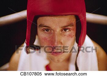 Stock Image - boxer with bloody 
nose. fotosearch 
- search stock 
photos, pictures, 
images, and photo 
clipart