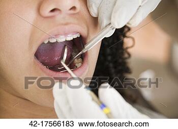 Stock Photo - teenage girl getting 
her mouth examined. 
fotosearch - search 
stock photos, 
pictures, images, 
and photo clipart