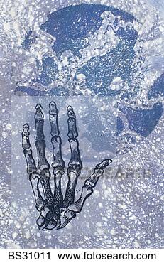 Stock Photography - skeleton of a 
human hand over 
a globe. fotosearch 
- search stock 
photos, pictures, 
images, and photo 
clipart