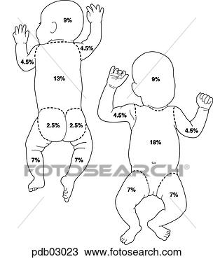 Drawing of Schematic drawing of infant showing body surface areas as ...